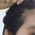 옆이마 비어보이는애들 꼭 이거 <b>하삼</b> ㅠㅠ
