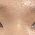 [댓글부탁해] 쌍수 심하게 ㅈ망이냐
