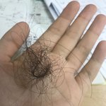 [댓글부탁해] <b>탈모</b>인지 아닌지 확인좀ㅜㅜ