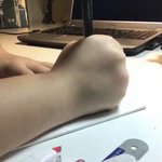 내 다이어트 <b>전후</b> 손 볼래?ㅋㅋㅋㅋ