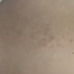 [댓글부탁해] 너네는 교복치마 입을때 <b>상처</b>생겨????