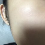 피부 어때??? ㄱㅊ?