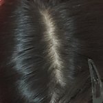 [댓글부탁해] 나 <b>정수리</b>가 좀 하얀데 탈모일까?