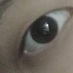[드루와] 나 쌍수하면 ㄱㅊ을거 같아???
