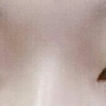 [이것좀봐줘] 늦은 <b>쌍수</b> 후기