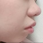 [댓글부탁해] 코 고민(사진주의)