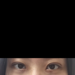 쌍수 8일차(사진있음)