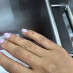 [이것좀봐줘] 네일아트 받고 <b>화상</b>입었어요