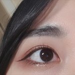 <b>쌍수</b>한지 1년됐는데 (사진