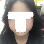 <b>사각</b>턱 보톡스 맞고왔다