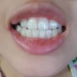 [댓글부탁해] 내 <b>이빨</b>