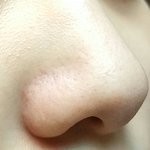 [댓글부탁해] 나 블랙<b>헤드</b> 심한 편이야?