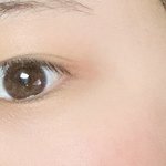 쌍수 추반 해줘,,,,ㅠㅠ
