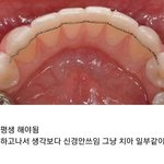 [모두드루와] 치아 교정전 이거 모르는 사람 많더라