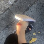 [댓글부탁해] 발 아스팔트에 <b>살짝</b> 부딫혔는데 이렇게됨 약혐