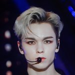 세븐틴 <b>버논</b> 얼굴 충격
