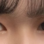 [댓글부탁해] 나 눈에 <b>색소</b>침착 ㅠㅠ