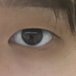 [드루와] <b>눈성형</b> 뭐뭐할까