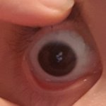 [댓글부탁해] 나 <b>동공</b> 작은편이야?