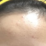 내 <b>이마라인</b> 어떻해?