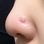 [조언부탁해] (혐짤주의)얘들아 나좀 도와줘ㄱㄱㄱㄱ