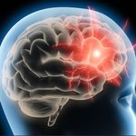[모두드루와] 정말 고통스러운 <b>통증</b>