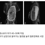 대식가의 위래 ㄷ
