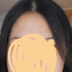 나 턱 비대칭 <b>심해</b>?