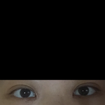 쌍수 한<b>달차</b>!!(사진ㅇ)