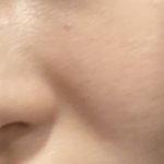 <b>팔자</b>주름 심한 애들 없니..? ㅠ