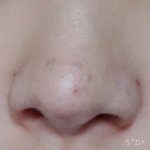 [댓글부탁해] 혐주의)블랙<b>헤드</b>?이거 어케