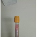 [모두드루와] <b>고도</b>비만인 사람들의 피