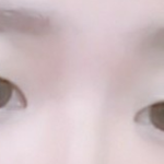 내 쌍수<b>전후</b> / 중박은 침