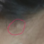 [댓글부탁해] 나 목 <b>뒤쪽</b>에 뭐가 났어