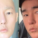 [댓글부탁해] 혈액암 <b>완치</b>한 허지웅