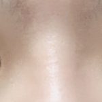 쌍수했는데 붓기좀 봐줘 ㅜㅜ