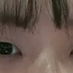 쌍수하는데 떨린다..(<b>사진o</b>)