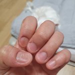 [댓글부탁해] 혐...?)<b>손톱</b> 뜯는 거 어떻게 고치지