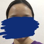 나 <b>이마</b> 김세정 수준으로 넓냐