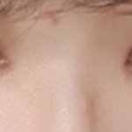 나 쌍수하고 오늘 <b>실밥</b> 풀었어