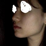 [댓글부탁해] 나 <b>사각</b>턱 고민인데 어떡할까 ,,