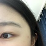 나처럼 왼쪽 오른쪽 눈 <b>차이</b> 심한 <b>사람</b> 있냐