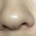 [조언부탁해] 나만큼 <b>모공</b> 심각한 애 있냐..