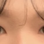 [댓글부탁해] 쌍커풀 <b>재수술</b> 각?