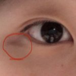 [댓글부탁해] <b>눈</b> <b>밑</b>에 애굣살도 아니고 이거 뭐임