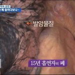 [19] 담배피는거 섹시하단 애들 조카 <b>한심</b>함