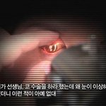 법적 규제가 절실해 보이는 콧대 필러 부작용 “실명 사례”