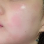 [뷰티] 생리하기 <b>직전</b>부터 피부 난리나는 사람? 빨리 가라앉는 팁...