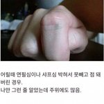 [댓글부탁해] 사람들 몸에 하나씩 있다는 <b>문신</b>
