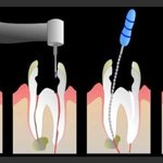 [댓글부탁해] 야 나 치과왔는데 인생 망한거 같아..